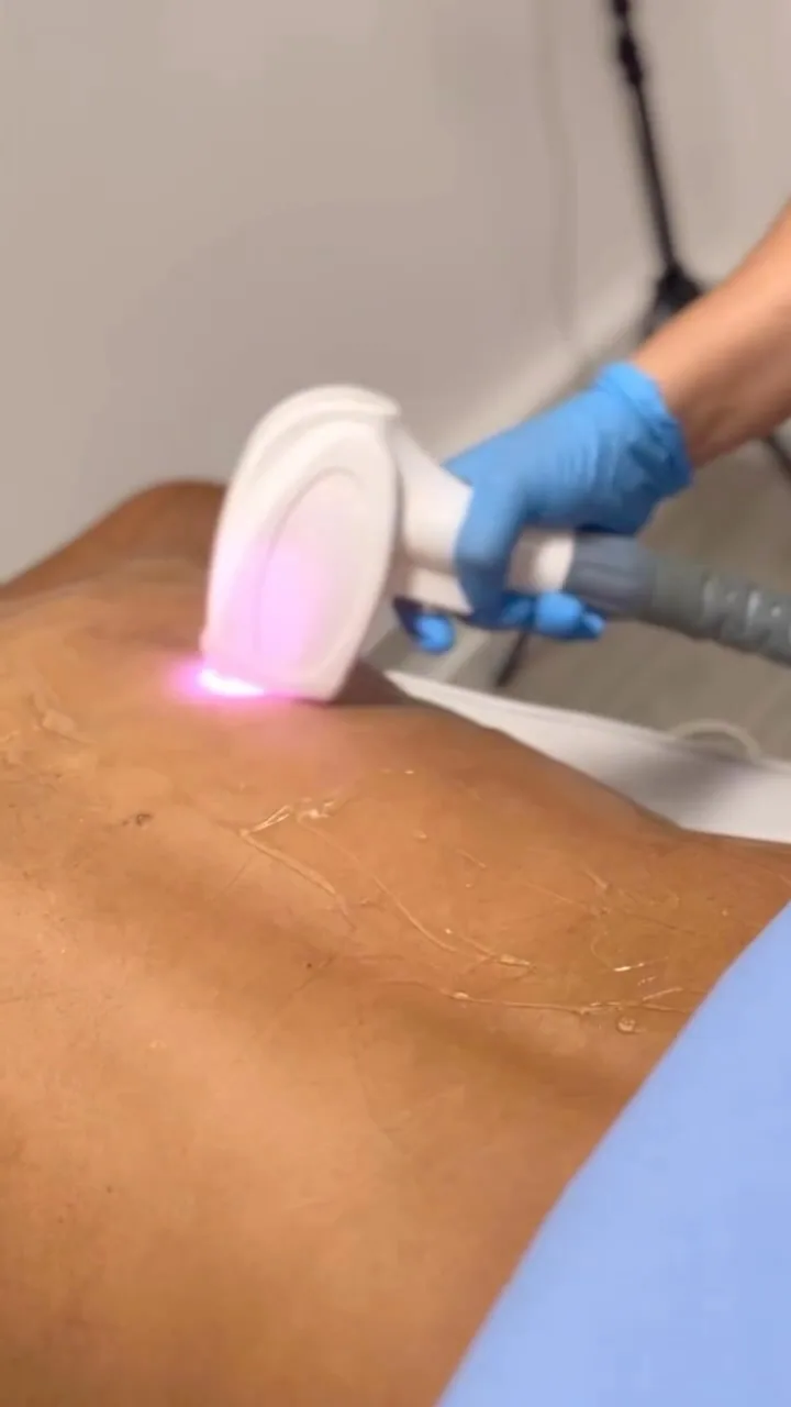 Tratamento corporal com tecnologia estética